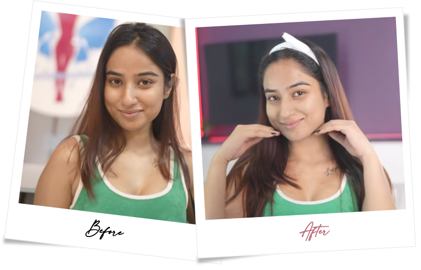 After treatment