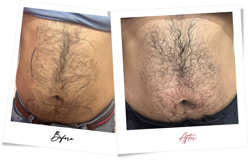 After treatment