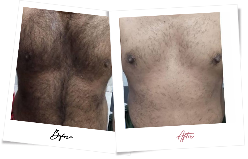 After treatment