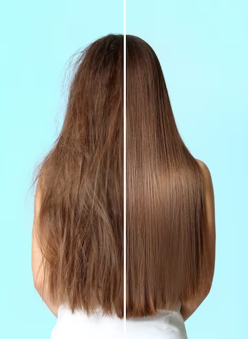 Hair Loss Treatment Provides a Way to Get Rid of Hair Loss and to Increase Hair Growth