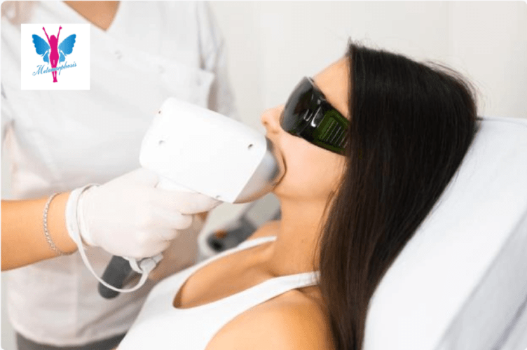 10 Interesting Facts About Laser Hair Removal For Your Face