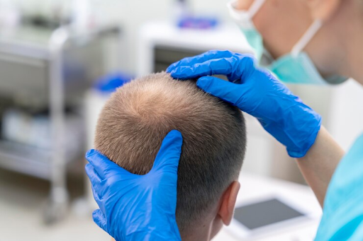 Top-Tier Hair Transplant Clinics in South Mumbai Worth the Consideration